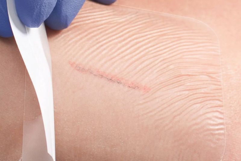 Transparent Films image