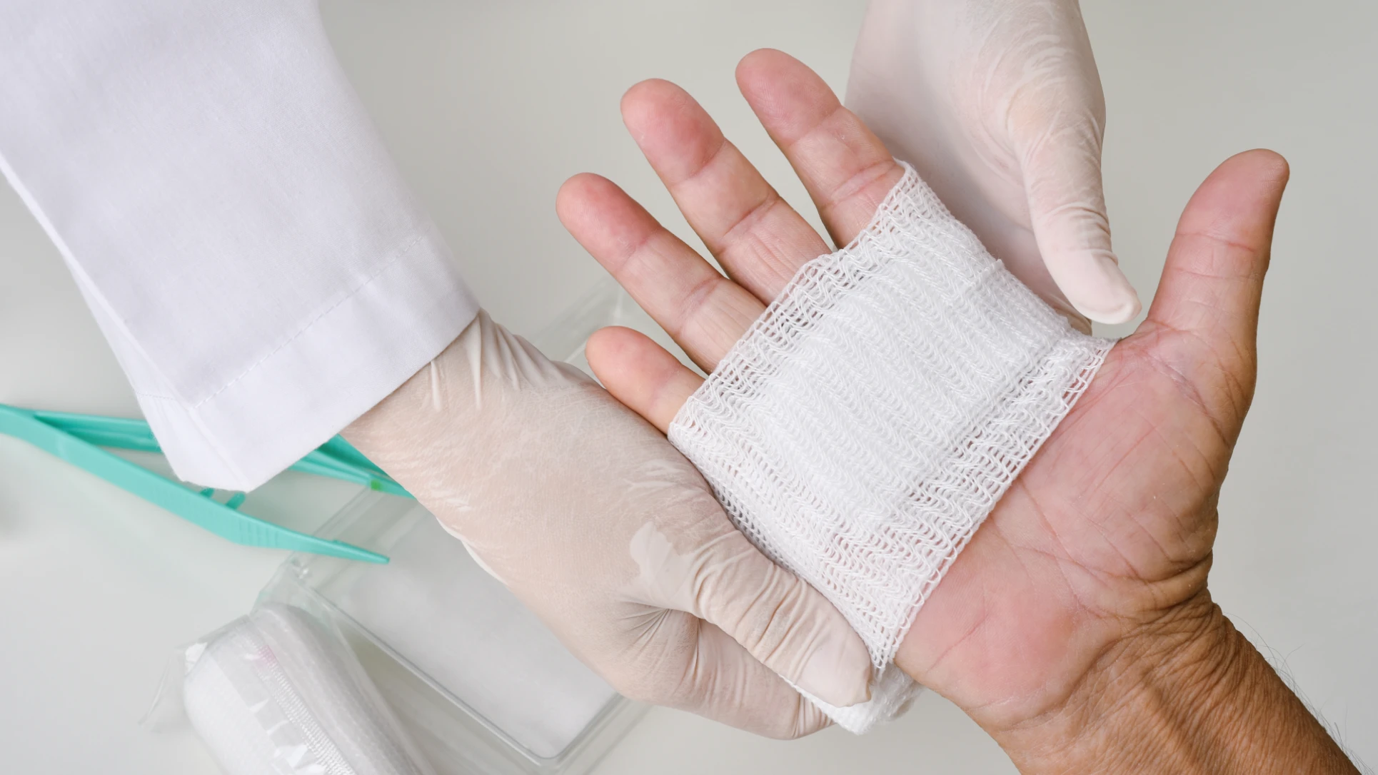 Integrative wound care treatment with a medical professional dressing a hand wound